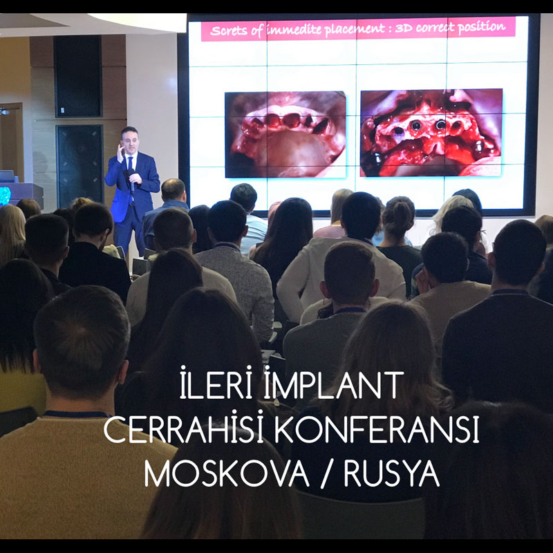 Moskova Konferansı