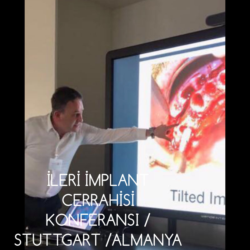 Stutgart Konferansı